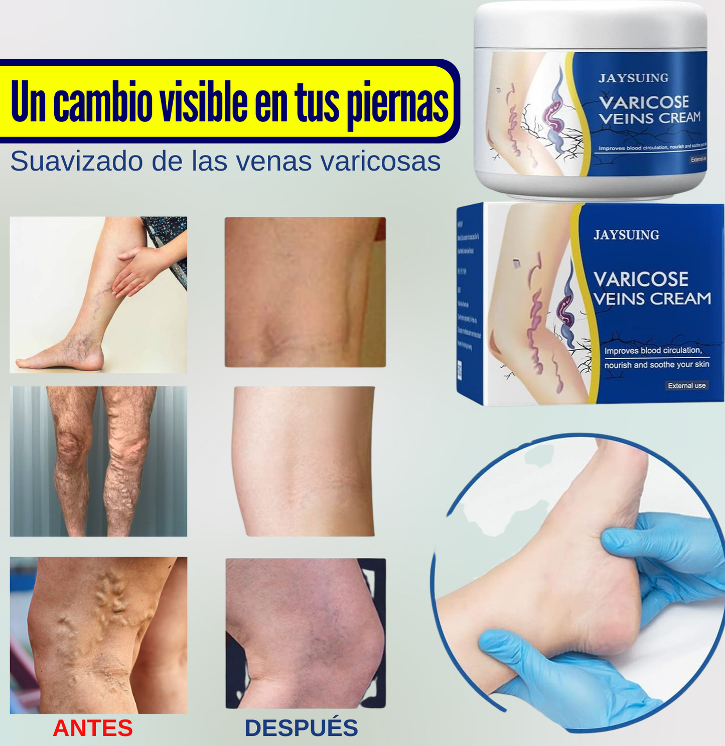 VARICOSE- ELIMINA VARICES