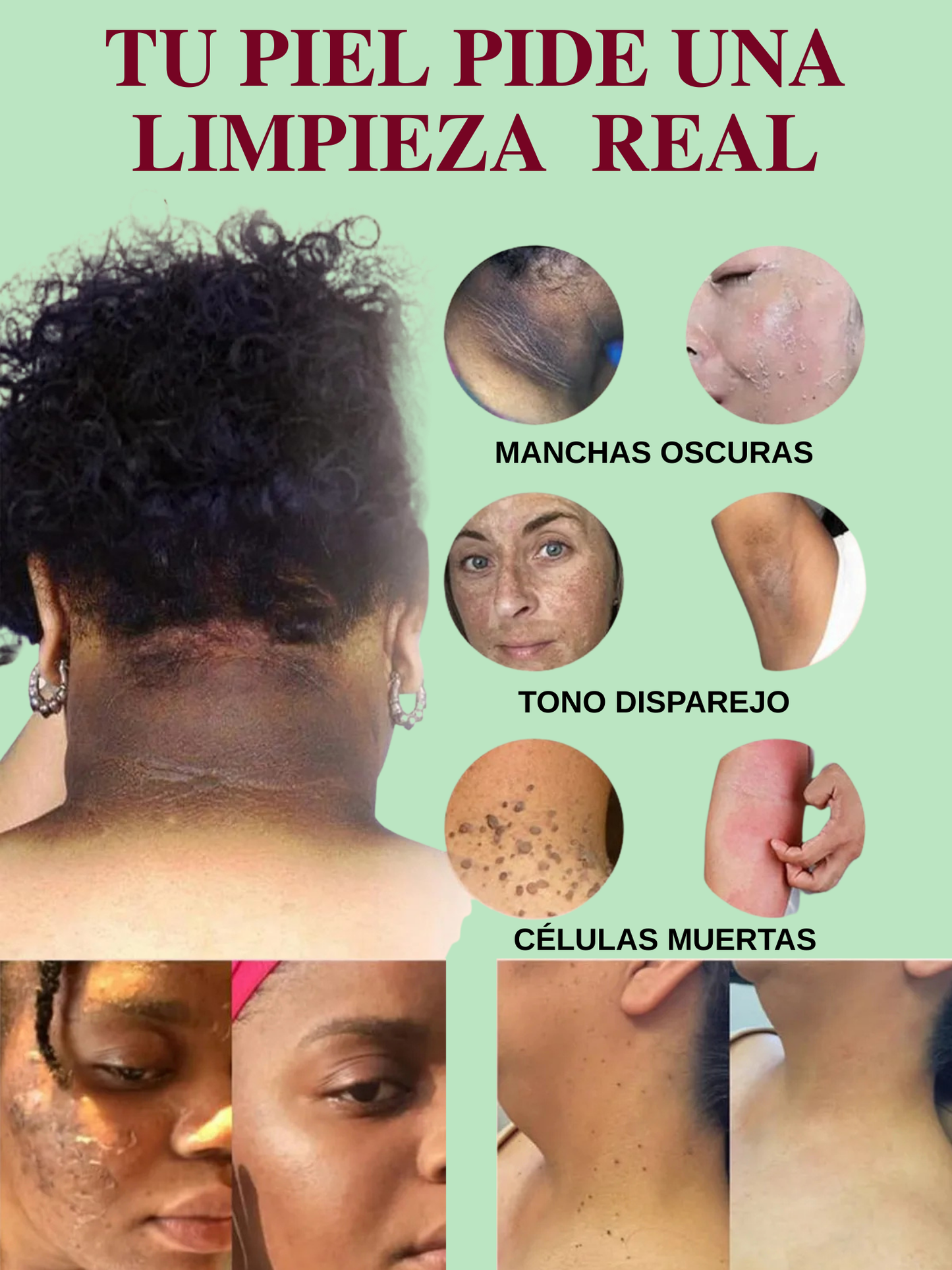 QUARXERY-ELIMINA MANCHAS