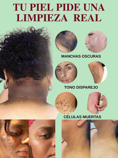 QUARXERY-ELIMINA MANCHAS