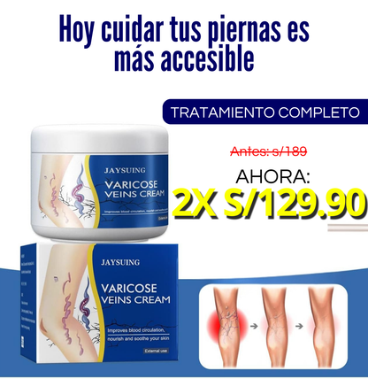 VARICOSE- ELIMINA VARICES